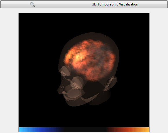 3DTomographicVisualization_Display.png
