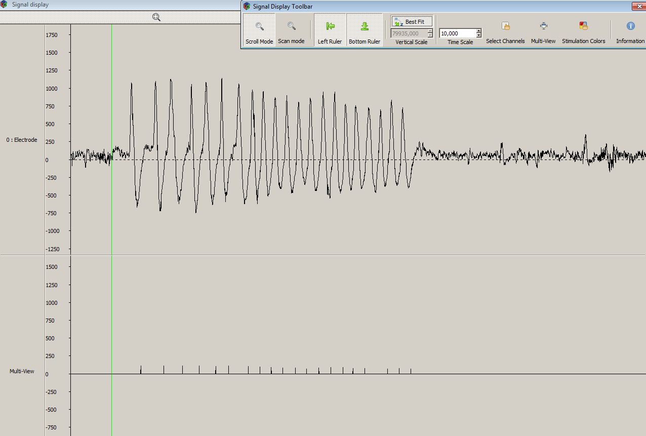 Screenshot-MindWave signals in Open Vibe Designer-TIME CORRELATION OF BLINK SIGNALS AND LARGE SWINGS IN RAW EEG SIGNAL - FAST BLINKING - 20062012-3.JPG