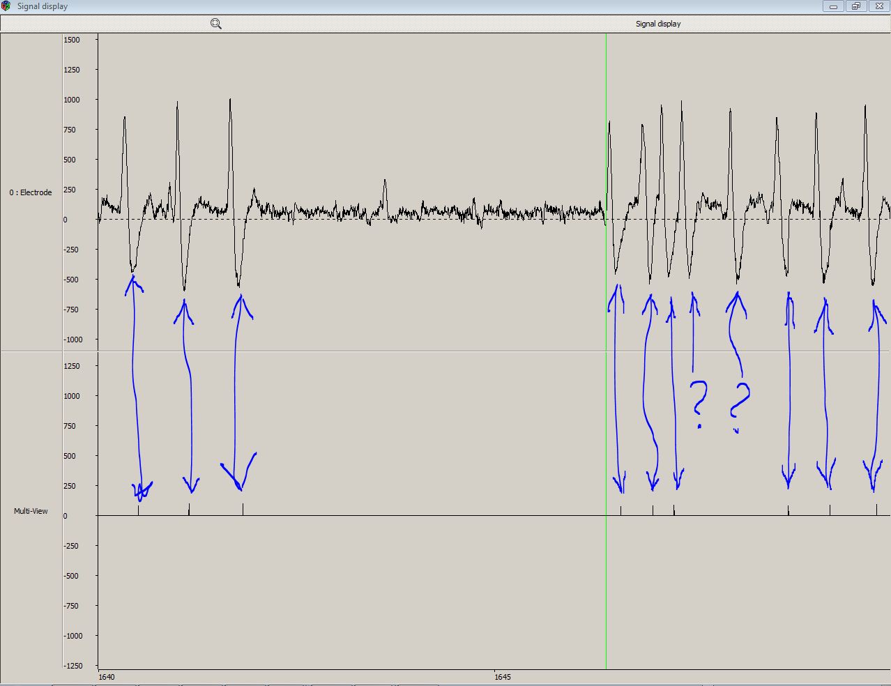 Screenshot-MindWave signals in Open Vibe Designer-TIME CORRELATION OF BLINK SIGNALS AND LARGE SWINGS IN RAW EEG SIGNAL - 20062012-2.JPG