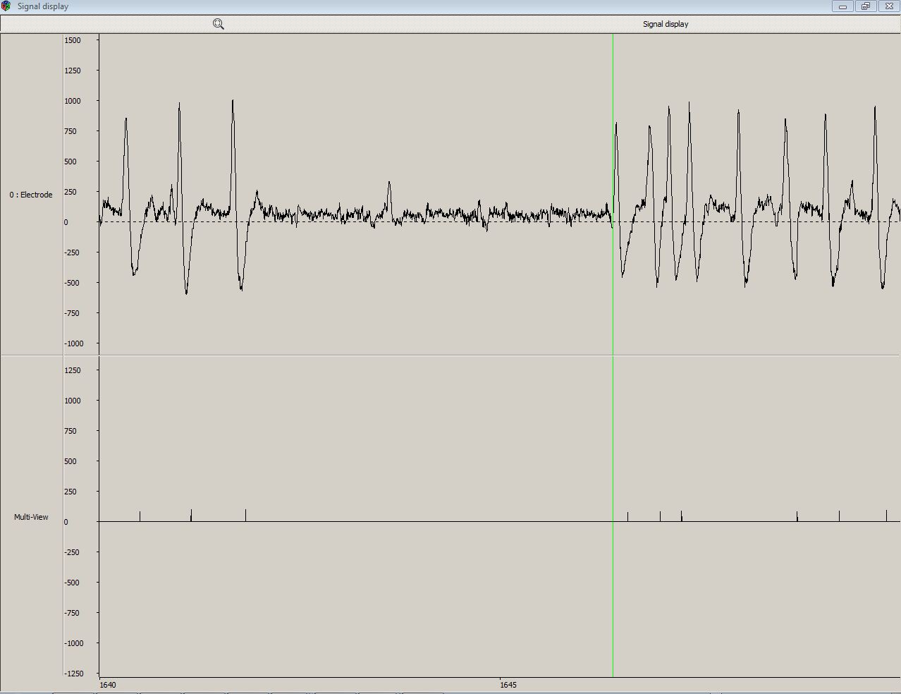 Screenshot-MindWave signals in Open Vibe Designer-TIME CORRELATION OF BLINK SIGNALS AND LARGE SWINGS IN RAW EEG SIGNAL - 20062012.JPG