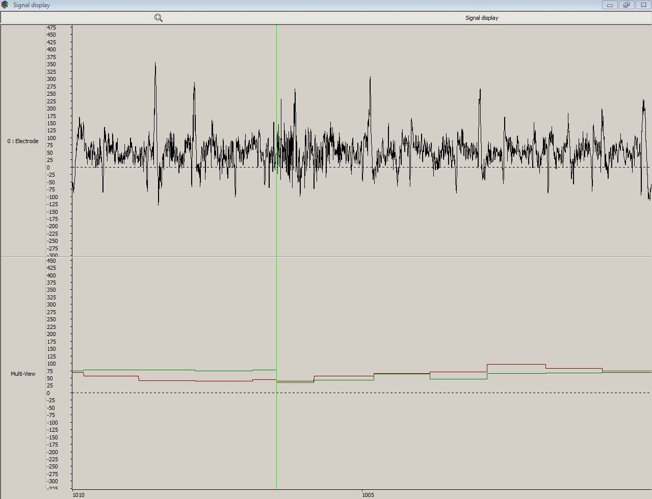 Screenshot-MindWave signals in Open Vibe Designer-Signal 1 - RAW EEG - In Multiview - ATTENTION AND MEDITATION - 20062012.JPG