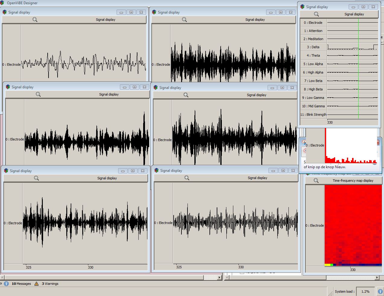 Screenshot-MindWave signals in Open Vibe Designer-READ CUSTOM MINDWAVE REALTIME FROM ACQ CLIENT  PLUS SPECTRA AND 6 BANDFILTERS - 20062012.JPG