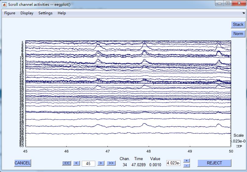 eeg.JPG