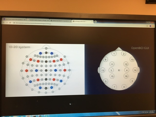 My 10-20 arrangement with 16 electrodes.